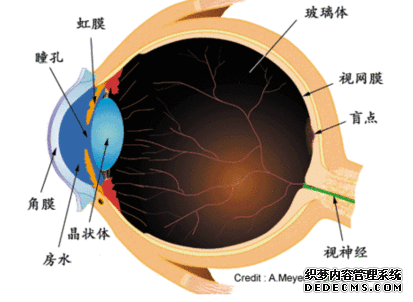 義眼適合什么樣的患者？